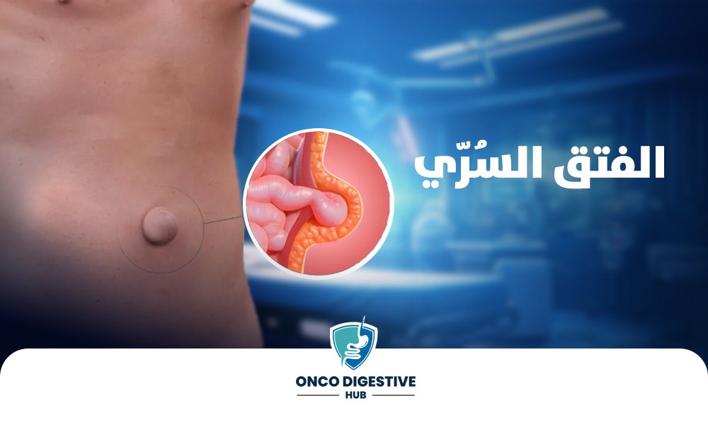 الفتق-السُرّي