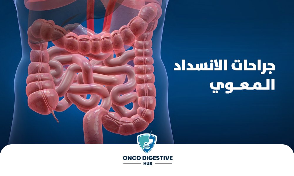 جراحات-الانسداد-المعوي