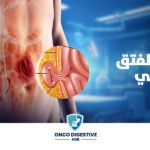 علاج الفتق الإربي بالمنظار مع أ.د. أحمد سفينة | الجراحة الأحدث والأسرع للتعافي